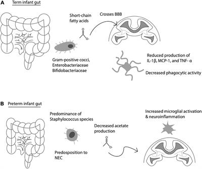 Congenital Infection Influence on Early Brain Development Through the Gut-Brain Axis